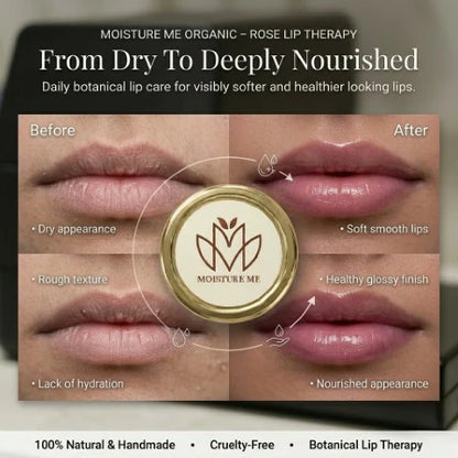 ROSE LIP THERAPY - 20g